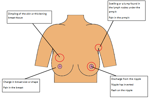 breast-cancer-signs-and-symptoms.png